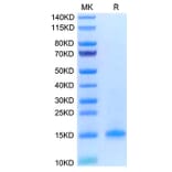 Tris-Bis PAGE - Recombinant Human CD3d Protein (C-terminal His Tag) (A330332) - Antibodies.com