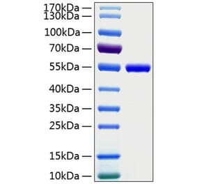 SDS-PAGE - Recombinant Human CD4 Protein (C-terminal His Tag) (A330333) - Antibodies.com