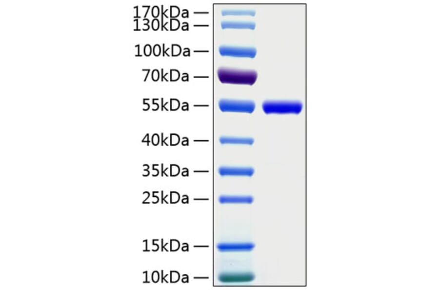 SDS-PAGE - Recombinant Human CD4 Protein (C-terminal His Tag) (A330333) - Antibodies.com
