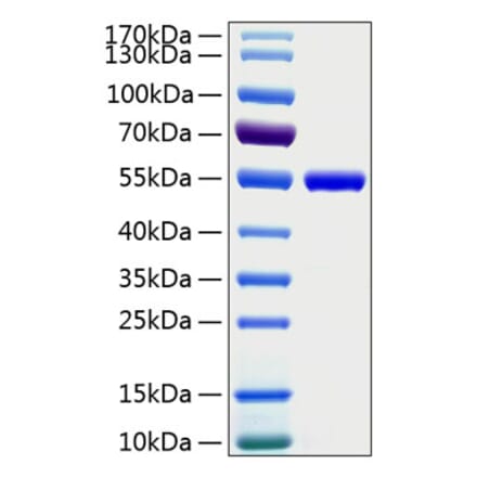 SDS-PAGE - Recombinant Human CD4 Protein (C-terminal His Tag) (A330333) - Antibodies.com