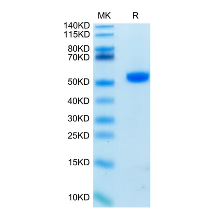 Tris-Bis PAGE - Recombinant Human CD4 Protein (Biotin) (C-terminal His and Avi Tag) (A330334) - Antibodies.com