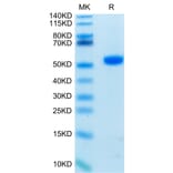 Tris-Bis PAGE - Recombinant Human CD4 Protein (Biotin) (C-terminal His and Avi Tag) (A330334) - Antibodies.com