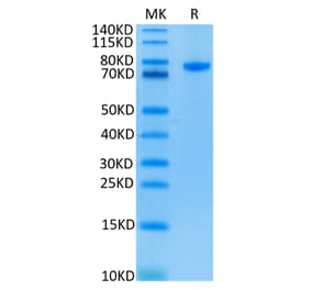 Tris-Bis PAGE - Recombinant Human CD4 Protein (C-terminal Human Fc Tag) (A330335) - Antibodies.com