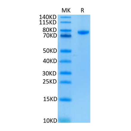 Tris-Bis PAGE - Recombinant Human CD4 Protein (C-terminal Human Fc Tag) (A330335) - Antibodies.com