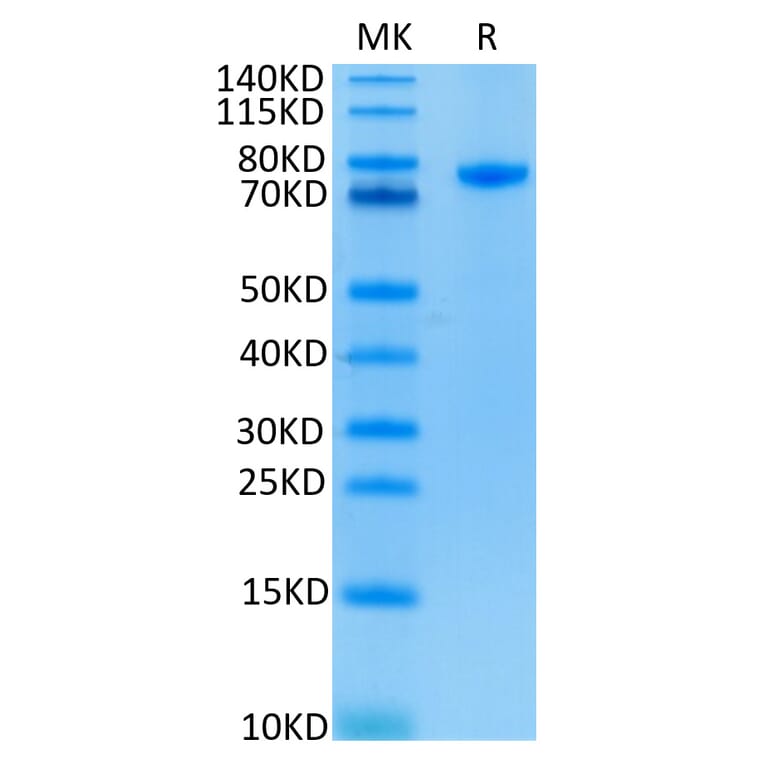 Tris-Bis PAGE - Recombinant Human CD4 Protein (C-terminal Human Fc Tag) (A330335) - Antibodies.com