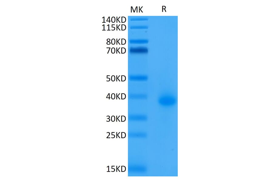 Tris-Bis PAGE - Recombinant Human CD40 Protein (Biotin) (C-terminal His and Avi Tag) (A330336) - Antibodies.com