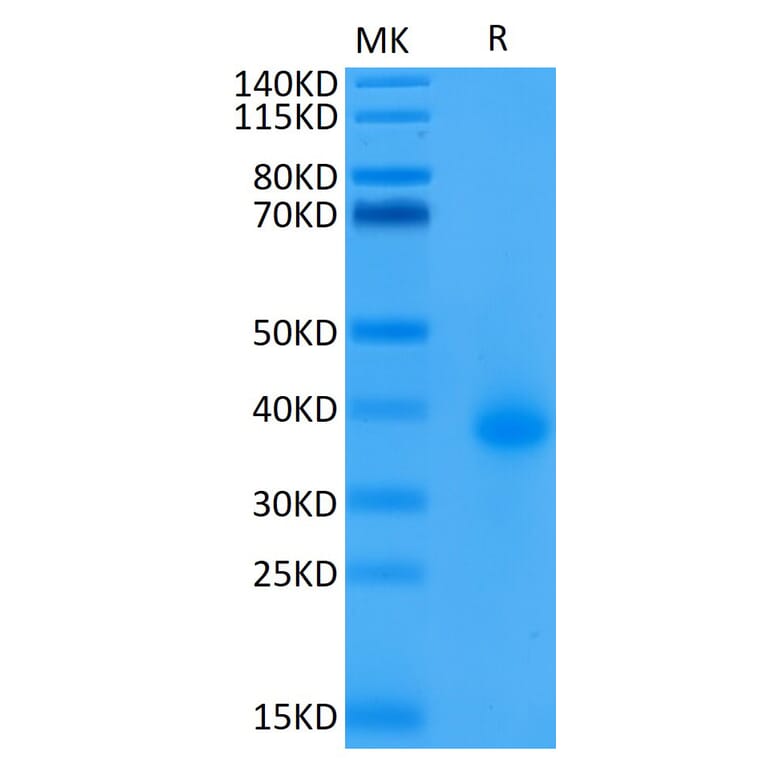 Tris-Bis PAGE - Recombinant Human CD40 Protein (Biotin) (C-terminal His and Avi Tag) (A330336) - Antibodies.com