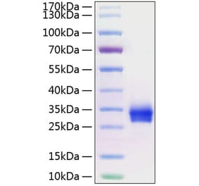 SDS-PAGE - Recombinant Human CD40 Protein (C-terminal His Tag) (A330337) - Antibodies.com