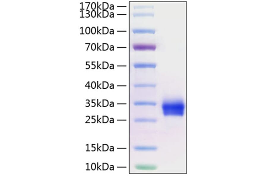 SDS-PAGE - Recombinant Human CD40 Protein (C-terminal His Tag) (A330337) - Antibodies.com