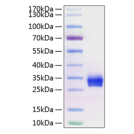 SDS-PAGE - Recombinant Human CD40 Protein (C-terminal His Tag) (A330337) - Antibodies.com