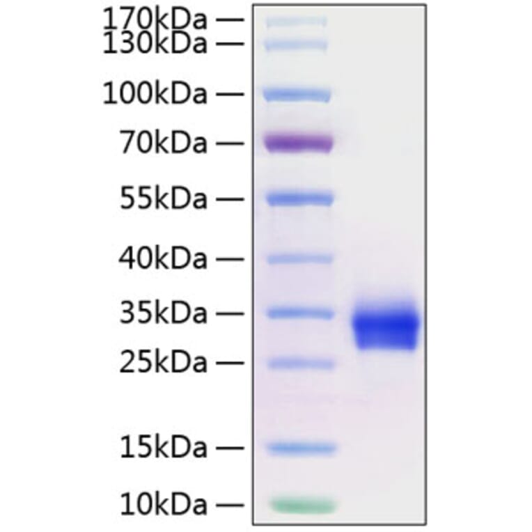 SDS-PAGE - Recombinant Human CD40 Protein (C-terminal His Tag) (A330337) - Antibodies.com