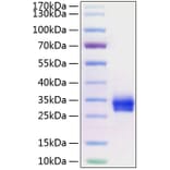 SDS-PAGE - Recombinant Human CD40 Protein (C-terminal His Tag) (A330337) - Antibodies.com