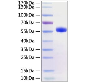SDS-PAGE - Recombinant Human CD40 Protein (C-terminal Human Fc and His Tag) (A330338) - Antibodies.com