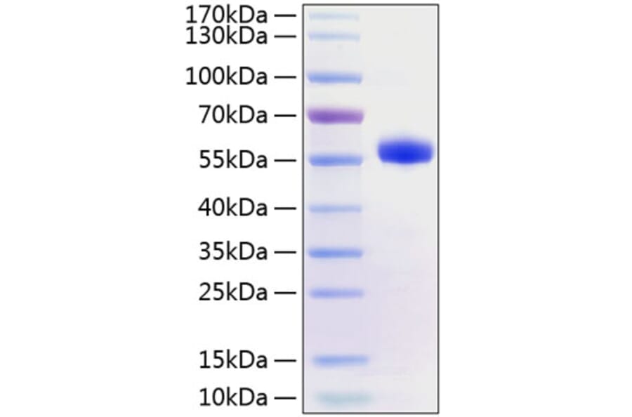 SDS-PAGE - Recombinant Human CD40 Protein (C-terminal Human Fc and His Tag) (A330338) - Antibodies.com