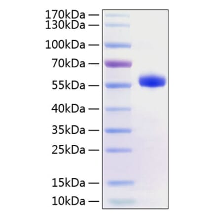 SDS-PAGE - Recombinant Human CD40 Protein (C-terminal Human Fc and His Tag) (A330338) - Antibodies.com