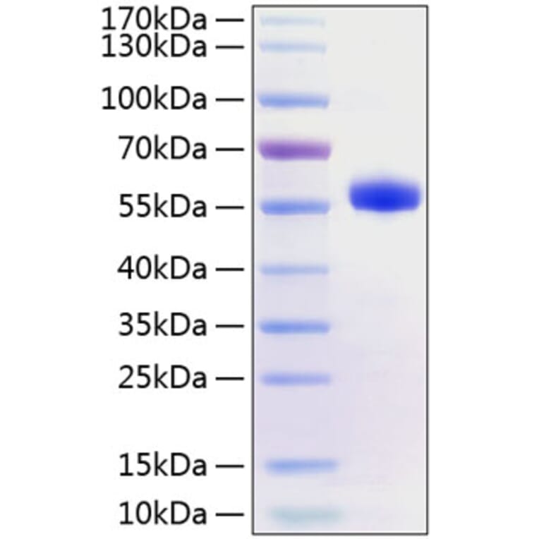 SDS-PAGE - Recombinant Human CD40 Protein (C-terminal Human Fc and His Tag) (A330338) - Antibodies.com