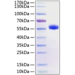 SDS-PAGE - Recombinant Human CD40 Protein (C-terminal Human Fc and His Tag) (A330338) - Antibodies.com