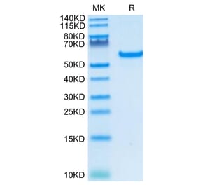 Tris-Bis PAGE - Recombinant Human CD40 Protein (C-terminal Human Fc Tag) (A330339) - Antibodies.com