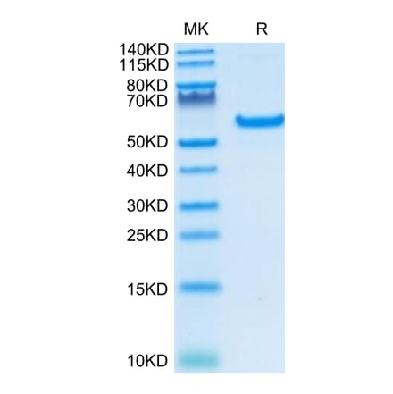 Tris-Bis PAGE - Recombinant Human CD40 Protein (C-terminal Human Fc Tag) (A330339) - Antibodies.com