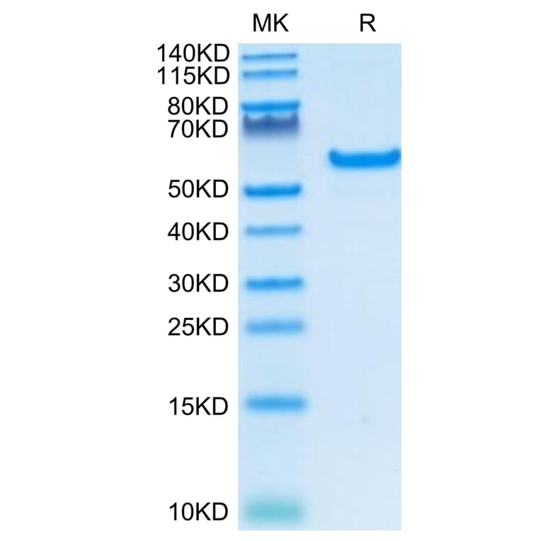 Tris-Bis PAGE - Recombinant Human CD40 Protein (C-terminal Human Fc Tag) (A330339) - Antibodies.com