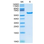 Tris-Bis PAGE - Recombinant Human CD40 Protein (C-terminal Human Fc Tag) (A330339) - Antibodies.com
