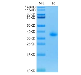 Tris-Bis PAGE - Recombinant Human CD40 Protein (C-terminal His Tag) (A330340) - Antibodies.com