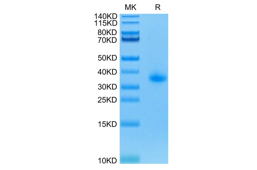 Tris-Bis PAGE - Recombinant Human CD40 Protein (C-terminal His Tag) (A330340) - Antibodies.com