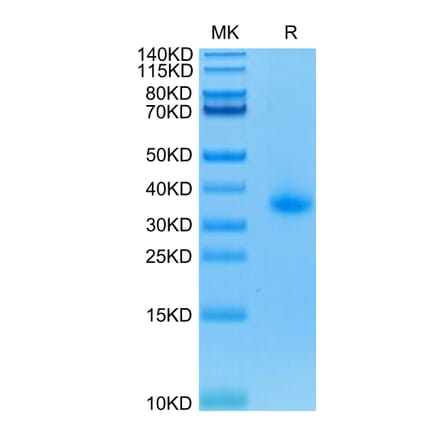 Tris-Bis PAGE - Recombinant Human CD40 Protein (C-terminal His Tag) (A330340) - Antibodies.com