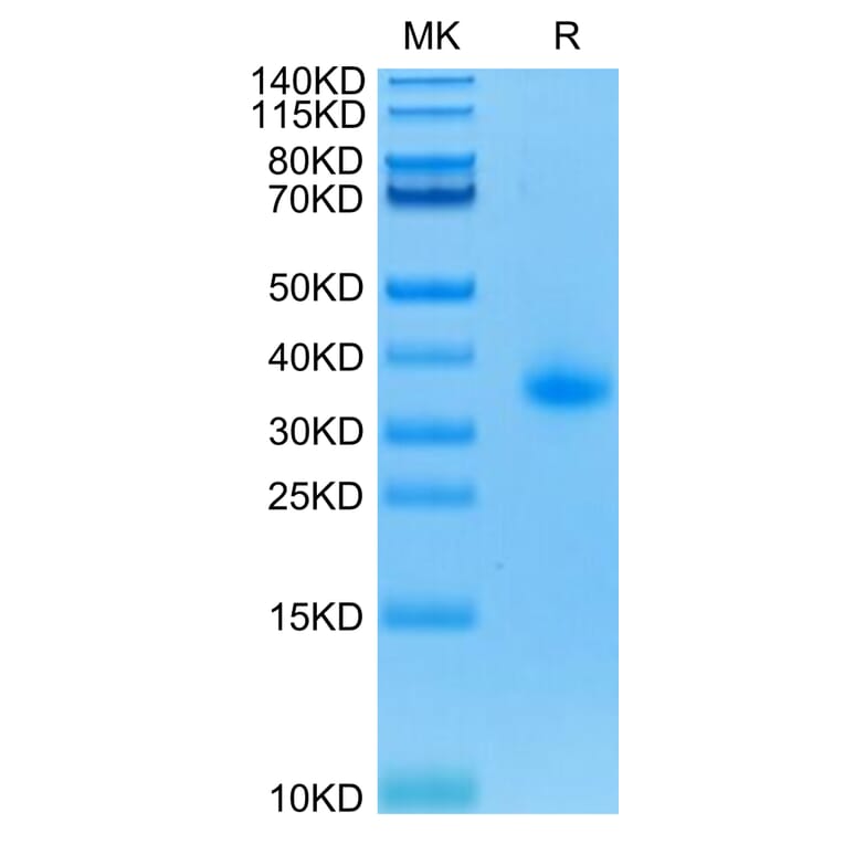 Tris-Bis PAGE - Recombinant Human CD40 Protein (C-terminal His Tag) (A330340) - Antibodies.com