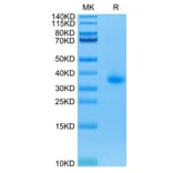 Tris-Bis PAGE - Recombinant Human CD40 Protein (C-terminal His Tag) (A330340) - Antibodies.com