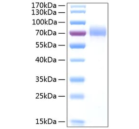 SDS-PAGE - Recombinant Human CD44 Protein (C-terminal Human Fc and His Tag) (A330341) - Antibodies.com