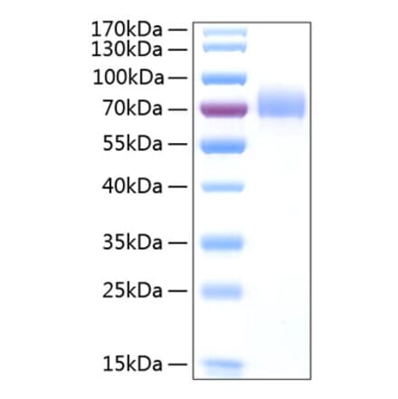 SDS-PAGE - Recombinant Human CD44 Protein (C-terminal Human Fc and His Tag) (A330341) - Antibodies.com