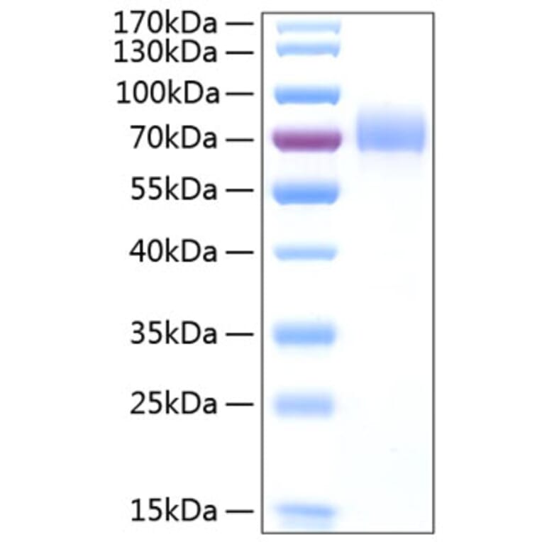 SDS-PAGE - Recombinant Human CD44 Protein (C-terminal Human Fc and His Tag) (A330341) - Antibodies.com