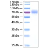 SDS-PAGE - Recombinant Human CD44 Protein (C-terminal Human Fc and His Tag) (A330341) - Antibodies.com