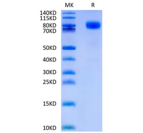 Tris-Bis PAGE - Recombinant Human CD44 Protein (C-terminal Human Fc Tag) (A330342) - Antibodies.com
