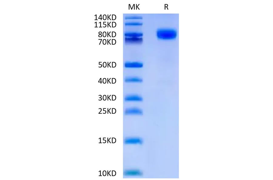Tris-Bis PAGE - Recombinant Human CD44 Protein (C-terminal Human Fc Tag) (A330342) - Antibodies.com