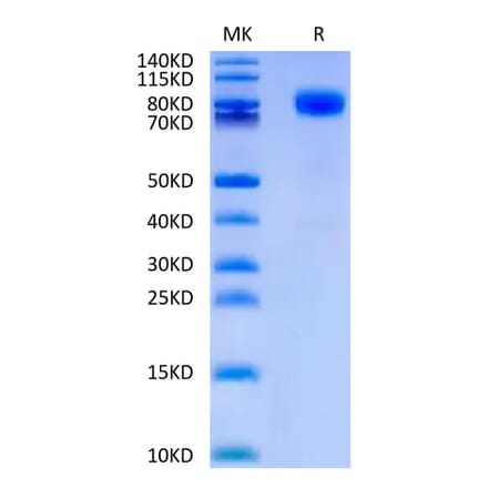 Tris-Bis PAGE - Recombinant Human CD44 Protein (C-terminal Human Fc Tag) (A330342) - Antibodies.com