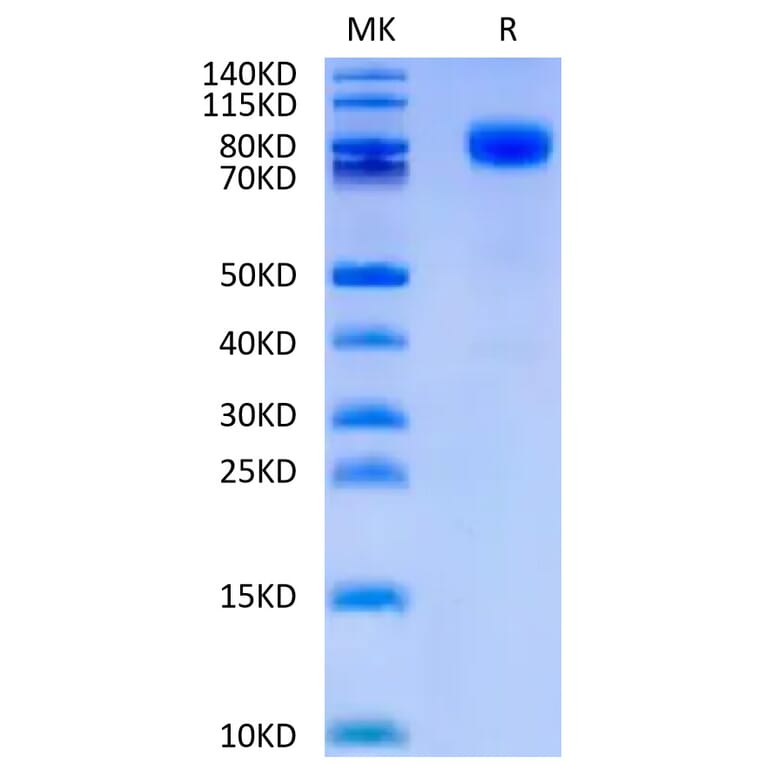 Tris-Bis PAGE - Recombinant Human CD44 Protein (C-terminal Human Fc Tag) (A330342) - Antibodies.com