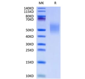 Tris-Bis PAGE - Recombinant Human CD44 Protein (C-terminal His Tag) (A330343) - Antibodies.com