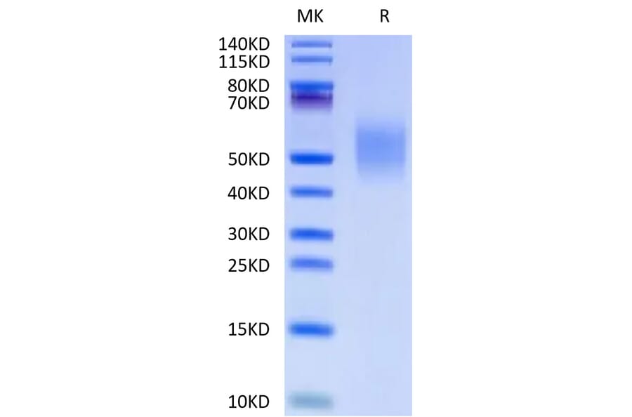 Tris-Bis PAGE - Recombinant Human CD44 Protein (C-terminal His Tag) (A330343) - Antibodies.com