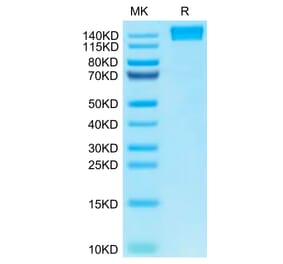 Tris-Bis PAGE - Recombinant Human CD45 Protein (C-terminal Human Fc Tag) (A330344) - Antibodies.com