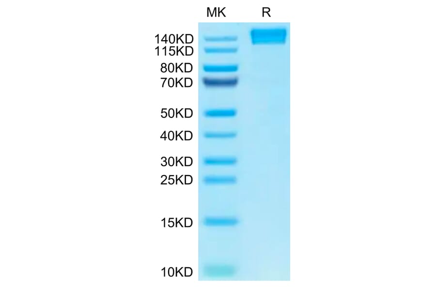 Tris-Bis PAGE - Recombinant Human CD45 Protein (C-terminal Human Fc Tag) (A330344) - Antibodies.com