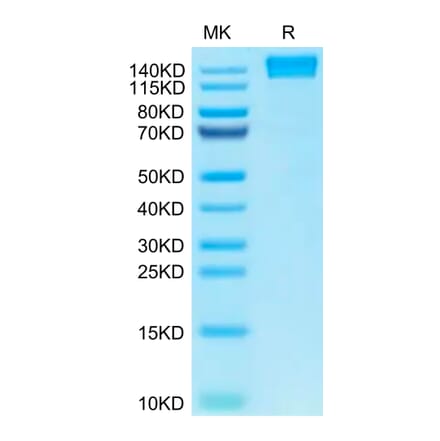 Tris-Bis PAGE - Recombinant Human CD45 Protein (C-terminal Human Fc Tag) (A330344) - Antibodies.com