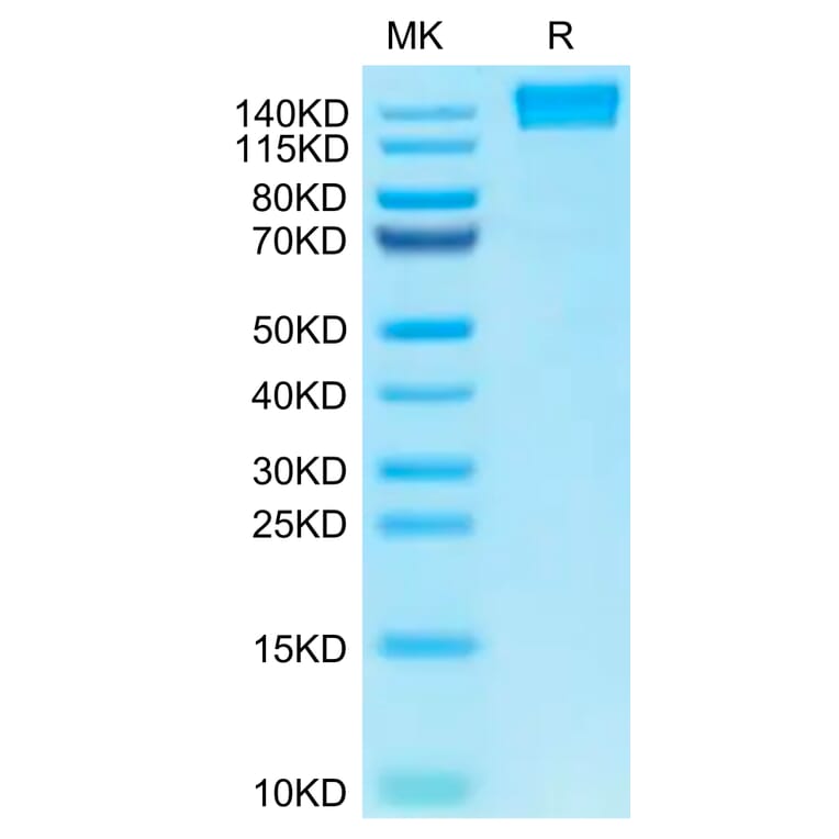 Tris-Bis PAGE - Recombinant Human CD45 Protein (C-terminal Human Fc Tag) (A330344) - Antibodies.com