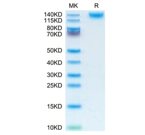 Tris-Bis PAGE - Recombinant Human CD45 Protein (C-terminal His Tag) (A330345) - Antibodies.com