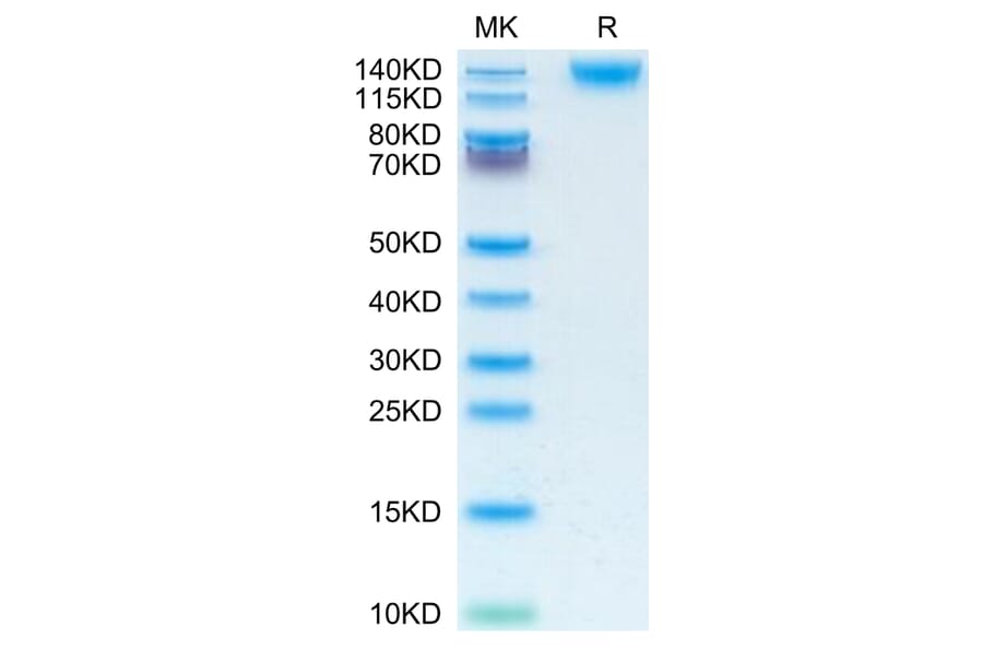 Tris-Bis PAGE - Recombinant Human CD45 Protein (C-terminal His Tag) (A330345) - Antibodies.com