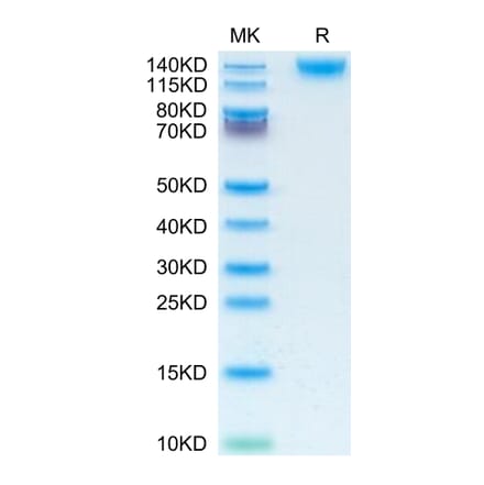 Tris-Bis PAGE - Recombinant Human CD45 Protein (C-terminal His Tag) (A330345) - Antibodies.com