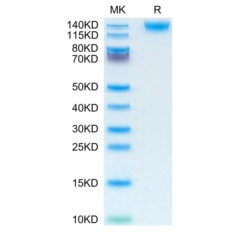 Tris-Bis PAGE - Recombinant Human CD45 Protein (C-terminal His Tag) (A330345) - Antibodies.com