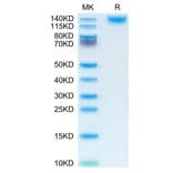 Tris-Bis PAGE - Recombinant Human CD45 Protein (C-terminal His Tag) (A330345) - Antibodies.com
