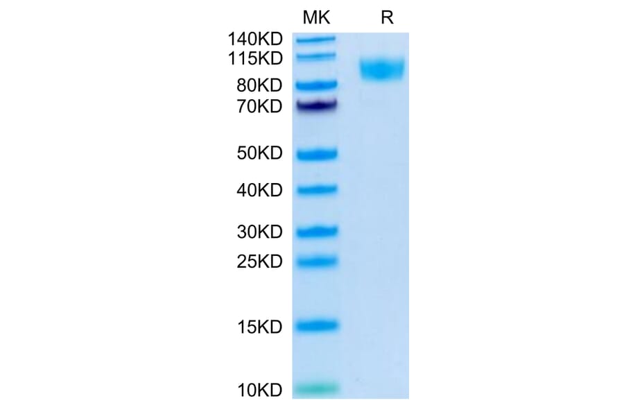 Tris-Bis PAGE - Recombinant Human CD45 Protein (Biotin) (C-terminal His and Avi Tag) (A330346) - Antibodies.com